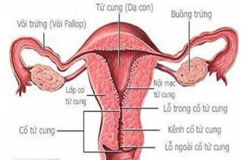 Hình ảnh sa tử cung ở phụ nữ